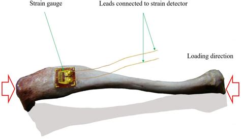 Soft tissue strain measurement 